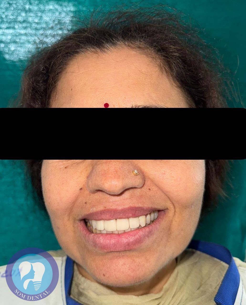 Smile Design Gallery